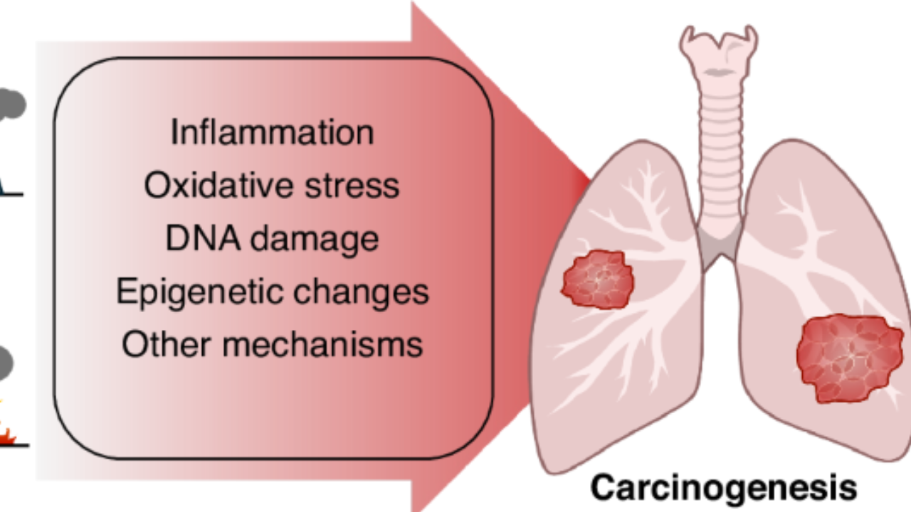 Pollution and Environmental Toxins
