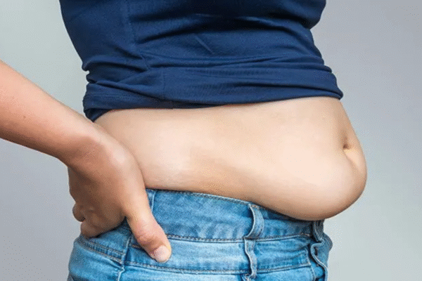 Belly Fat in Women