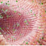 Gut Microbiota Dysbiosis